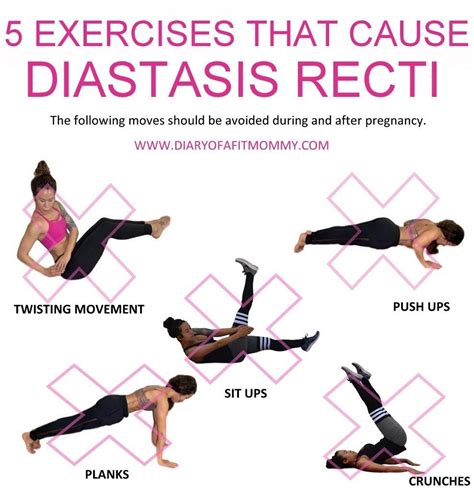Abs Exercises That Can Help Heal Diastasis Recti. During pregnancy, many women experience a separation of their abdominal muscles. Fortunately, the right kind of exercise can help your body heal. By Cassie Shortsleeve. Published on March 27, 2018. During pregnancy, your body goes through a lot of changes. And despite what celebrity …